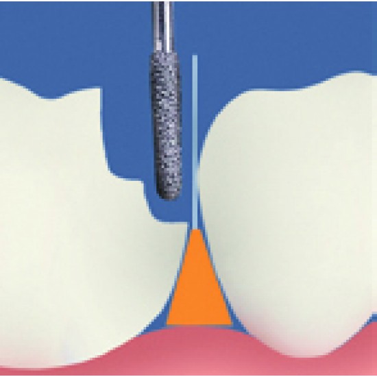 FENDERWEDGE FENDERWEDGE