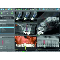 coDiagnostiX